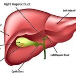 What You Need To Know About Gallbladder Cancer Surgery?